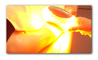 静岡の脱毛サロン10分　2000円光脱毛機での処理　静岡　脱毛　エステ　エル　L